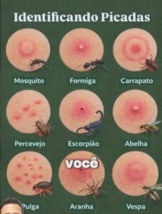 Picadas de Insetos: Como Identificar Cada Uma